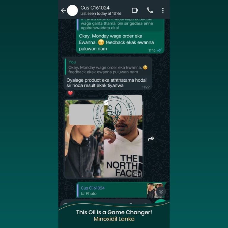 Minoxidil Testimonial