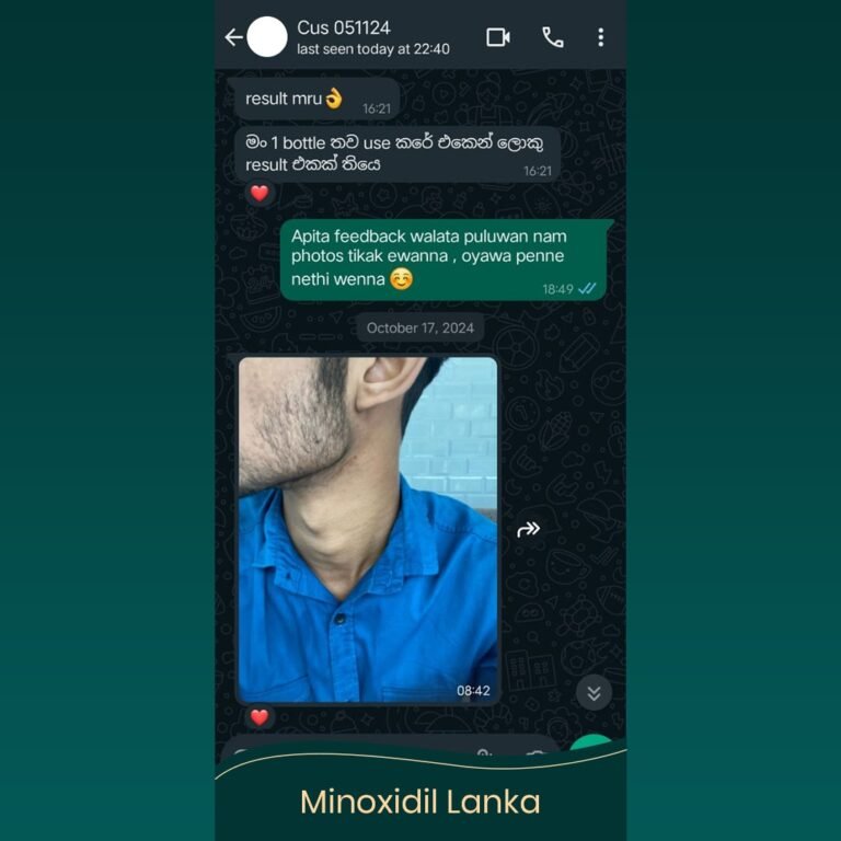 Minoxidil Testimonial