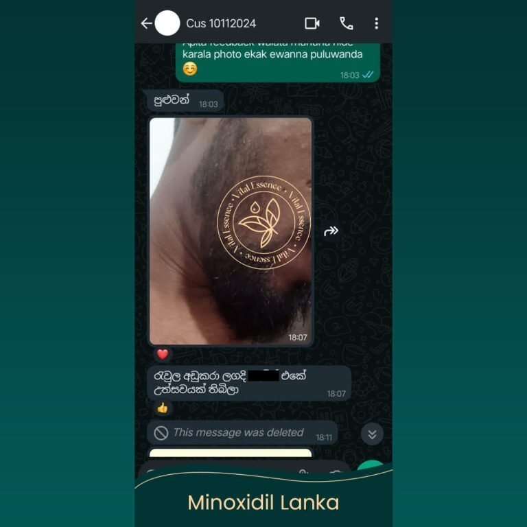 Minoxidil Testimonial
