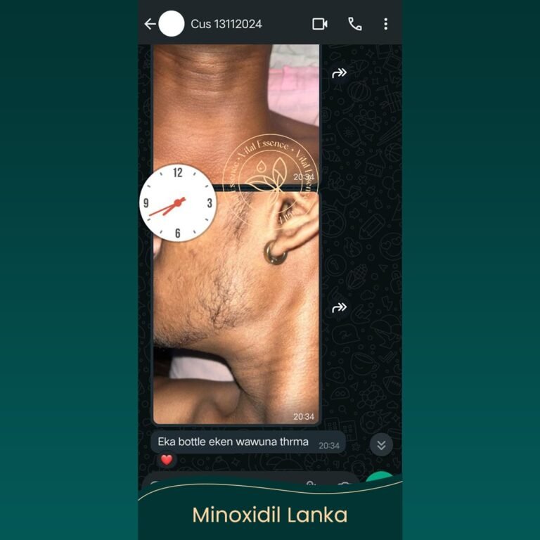 Minoxidil Testimonial
