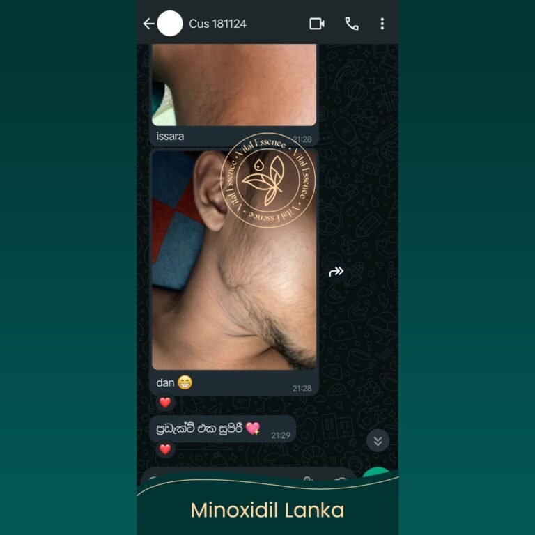 Minoxidil Testimonial